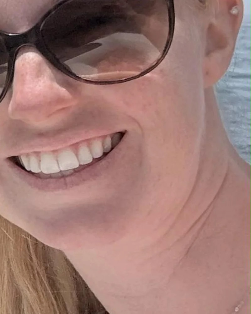 The same customer smiling, after using the tallow face and body balm
